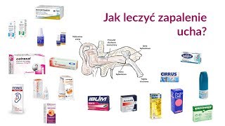 Jak leczyć zapalenie ucha [upl. by Moya313]