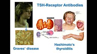 TSH Receptor Antibodies Nomenclature Functionality and Assay Comparison [upl. by Lolanthe]