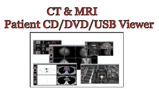 How to Export CBCT DICOM from Sidexis 4 Dental [upl. by Anabelle]