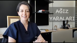 Ağız Yarası İçin Neler Yapılabilir [upl. by Ykciv]