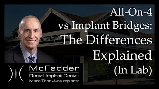 AllOn4 vs Implant Bridges Explained In The Lab [upl. by Wearing373]