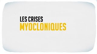 Les crises myocloniques [upl. by Jevon59]