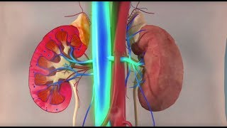 Rhabdomyolysis  Mayo Clinic [upl. by Nee23]