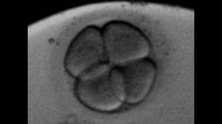 Rotation of the blastomeres at 4cells human embryoavi [upl. by Ainollopa]