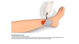 How to use the Silvercel NonAdherent Hydro Alginate Antimicrobial Dressing [upl. by Reuven976]