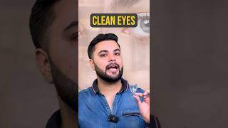 Puffy Eyes Eye Bags amp Dark Circles Treatment Solution for Brighter Eyes [upl. by Salem]