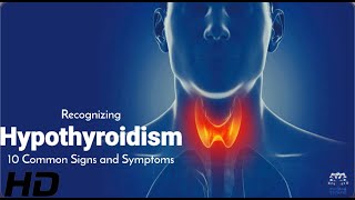 Hypothyroidism Explained 10 Symptoms That Could Be Affecting You [upl. by Ednyl]