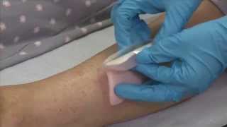 ALLEVYN Adhesive application to the leg [upl. by Dublin]