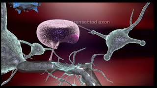 Mechanism of Action of Natalizumab a medication used to treat multiple sclerosis amp Crohns disease [upl. by Kirschner305]