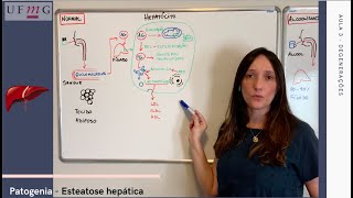 Como Tratar Esteatose Hepática Grau 2  Prof Dr Luiz Carneiro CRM 22761 [upl. by Standing496]