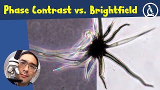 🔬 Brightfield vs Phase Contrast Microscopy Compared  Amateur Microscopy [upl. by Rizzo]