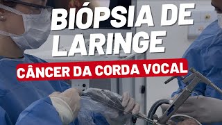 Biópsia de Laringe Veja Como é Feita Exame do câncer de laringe [upl. by Heidi]