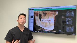 IV Sedation vs Oral Sedation [upl. by Frydman]