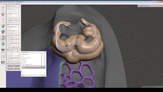 Come creare elementi complessi per odontoiatria con Autodesk Meshmixer [upl. by Latashia]