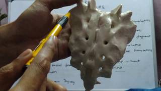 Sacrum fractures classification [upl. by Stevana161]