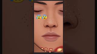 🧡🍁ASMR Face Blackheads And pimples popping Treatment 🌈❤  asmrvideos shorts 3danimation viral [upl. by Fricke210]