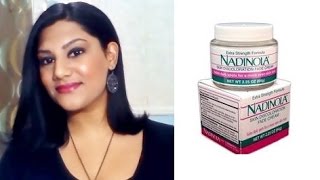 Nadinola Skin Discoloration Fade Cream Review [upl. by Acinorev]