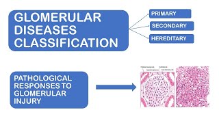 Glomerular Diseases Classification  Pathological Response to Glomerulus Injury  Made Easy [upl. by Woodberry]