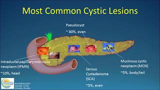 How to perform an ultrasound exam of the pancreas [upl. by Fazeli80]