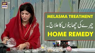 Melasma Remedy  Chehre ki Chaiyon ka Ilaaj GoodMorningPakistan [upl. by Yeltihw]