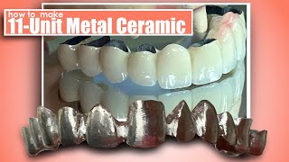 How to Make an 11Unit Metal Ceramic Restoration [upl. by Marrin]