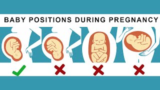 What is Anterior Posterior Breech and Transverse lie [upl. by Lewiss]