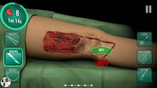 Gaping Wound in my new hospital My Operate Now Hospital Stream [upl. by Ithsav531]