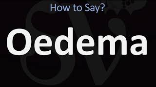 How to Pronounce Oedema CORRECTLY [upl. by Gilbert]