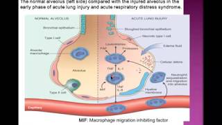 Respiratory system pathology [upl. by Koch]