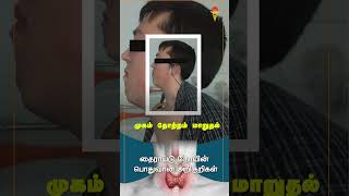 Symptoms of Thyroid  adhiparasakthihospitals tamil melmaruvathur doctor shortsvideo symptoms [upl. by Nickelsen]