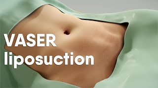 VASER liposuction is also called ultrasoundassisted liposuction VASER lipo or LipoSculpting [upl. by Ledeen654]