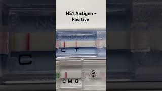 NS1 Antigen  Positive  Dengue test procedure  medicallaboratory shorts nursing [upl. by Alidus]