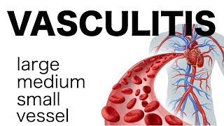 Vasculitis [upl. by Otinauj]