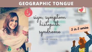 geographic tongue [upl. by Shauna289]