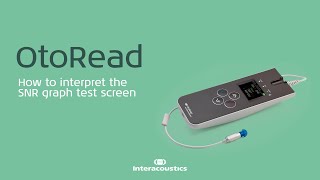 OtoRead How to interpret the SNR graph test screen [upl. by Edyth]