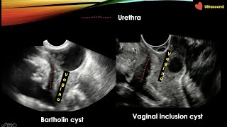 Why Choose the ObGyn Residency Program at HUP [upl. by Krystyna]