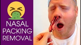 Anterior Packing in Epistaxis [upl. by Ruzich]