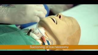 Tracheostomy Suctioning Tutorial [upl. by Miles]