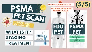 What is a PSMA PET scan  Overview for Med Students  Urology [upl. by Ailaza]