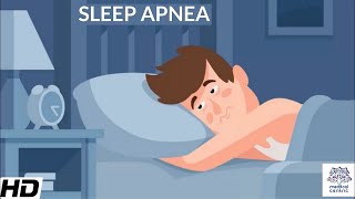 Sleep Apnea Symptoms Causes amp Treatment  Dr Shivani Swami  Narayana Health [upl. by Ailana537]