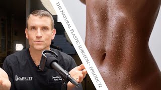 32 Everything You Need To Know About Liposuction [upl. by Ashby]