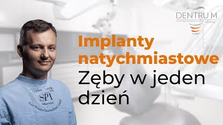 Implanty zębów implanty natychmiastowe zęby w jeden dzień [upl. by Byler]