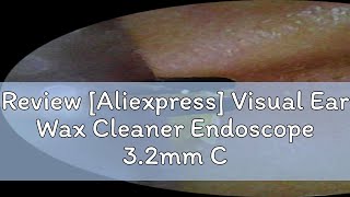 Review Aliexpress Visual Ear Wax Cleaner Endoscope 32mm Camera Len Electric Ear Cleaner Otoscope [upl. by Stein]