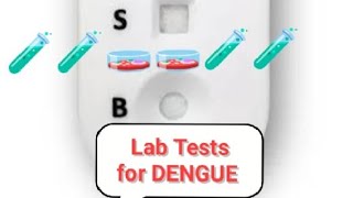 What are LAB TESTS in Dengue [upl. by Neelav826]