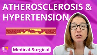 Atherosclerosis and Hypertension  MedicalSurgical  Cardiovascular System  LevelUpRN [upl. by Ayo]