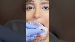 Ivoclar Instruction of Optragate lipcheekretractor Burmese [upl. by Yatnohs]