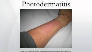 Photodermatitis [upl. by Ayyidas114]