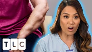 Dr Lee Removes 68 LIPOMAS From A Patients Arms  Dr Pimple Popper [upl. by Alled]