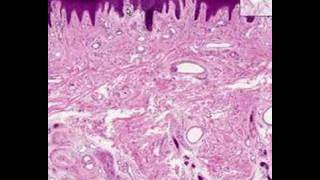 Shotgun Histology Thick Skin [upl. by Acirtal]