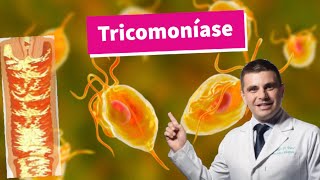 Tricomoníase [upl. by Puto]